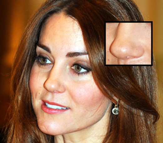 Kate Middleton's nose