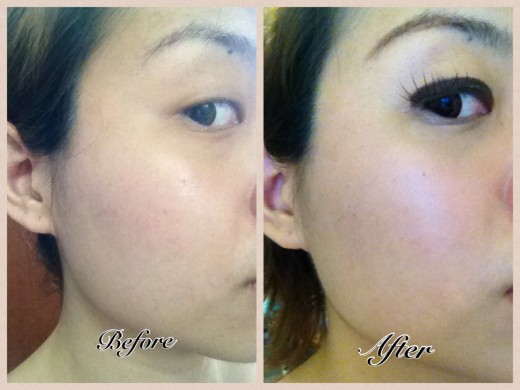 under eye Circles and Blemishes snap